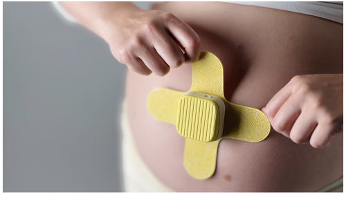 En gravid mage som sätter fast en gul mojäng som sitter fast som ett stort plåster